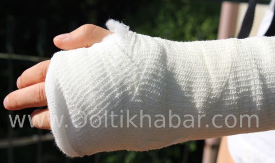 Sprains और Strains के लिए कौन से घरेलू उपचार प्रभावी हैं?