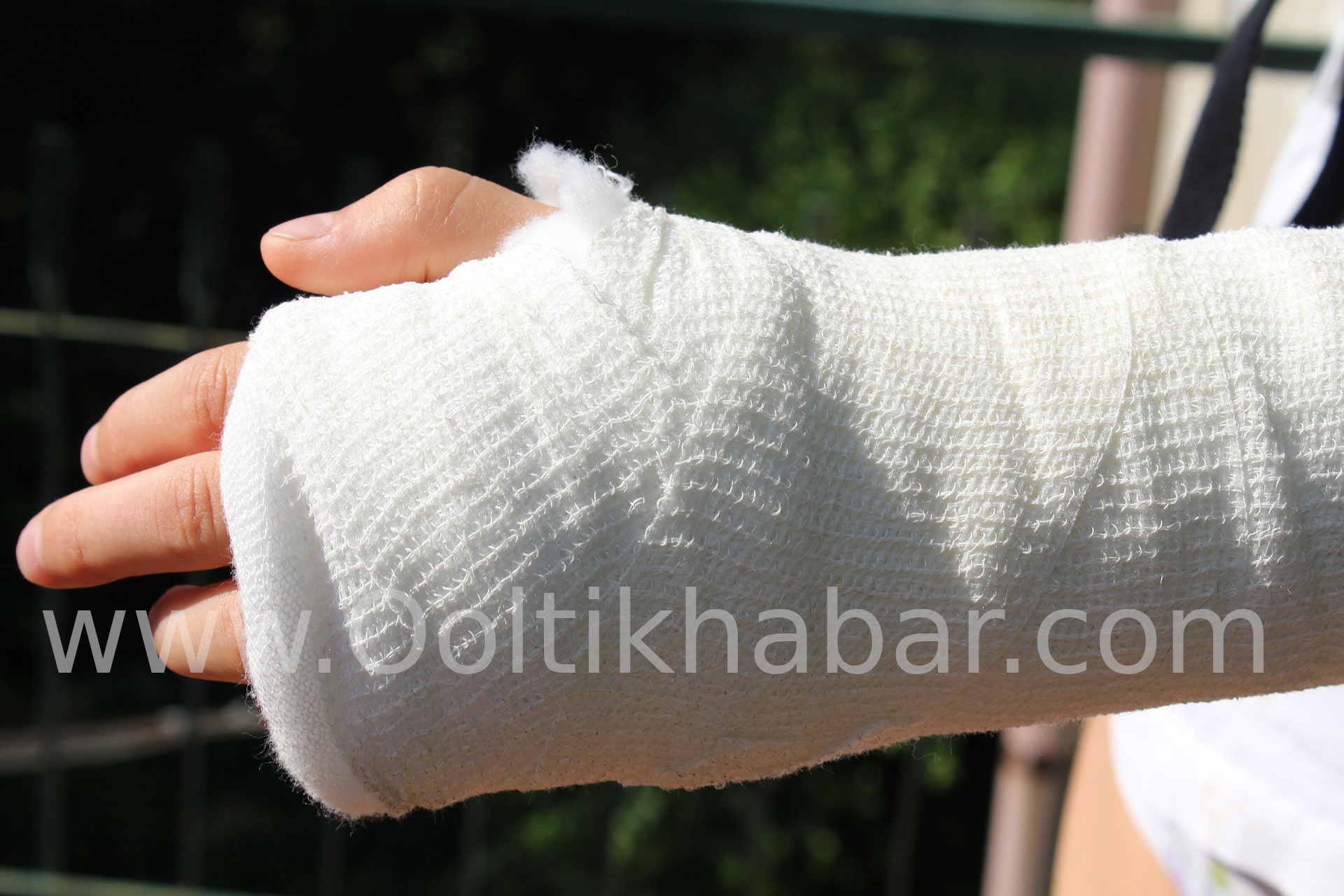 You are currently viewing Sprains और Strains के लिए कौन से घरेलू उपचार प्रभावी हैं?