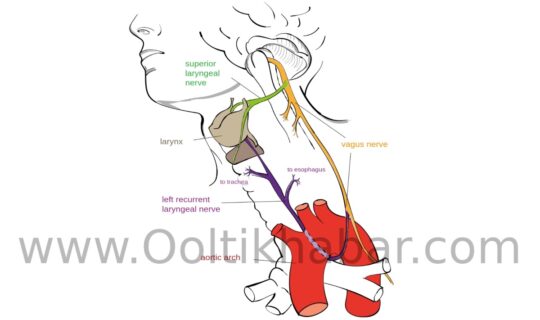 Hoarseness (गला बैठ जाना)को ठीक करने के घरेलू उपाय