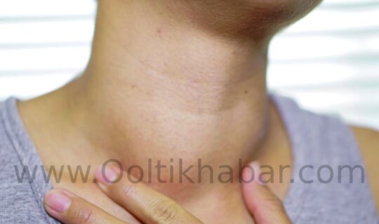 Hyperthyroidism के लिए घरेलू उपचार