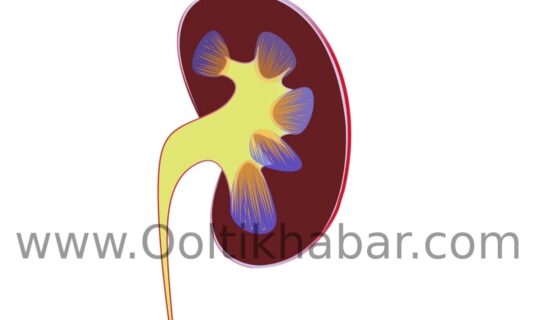 Kidney Stones को प्राकृतिक रूप से Dissolve करने के 5 तरीके